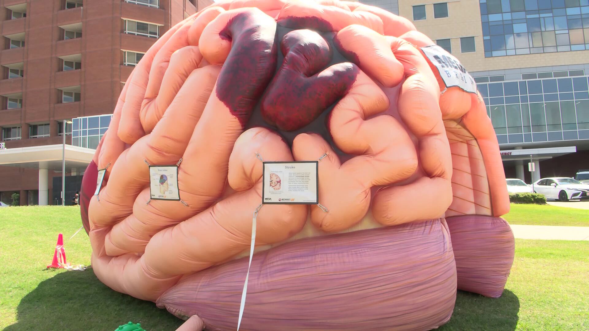 Healthier 901: Big Brain tours provide an inside look at stroke signs and symptoms - Vimarsana News